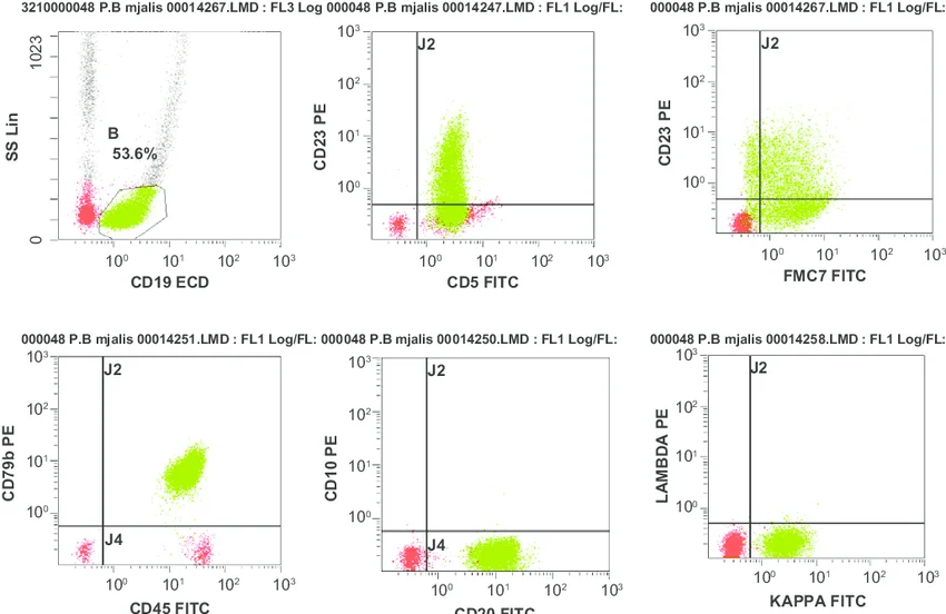 Flow cytometry - Immunophenotypic signature